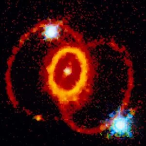 Rings around supernova remnant SN 1987a